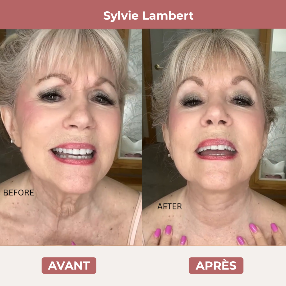 VieLoft Neck - Patchs remodelants