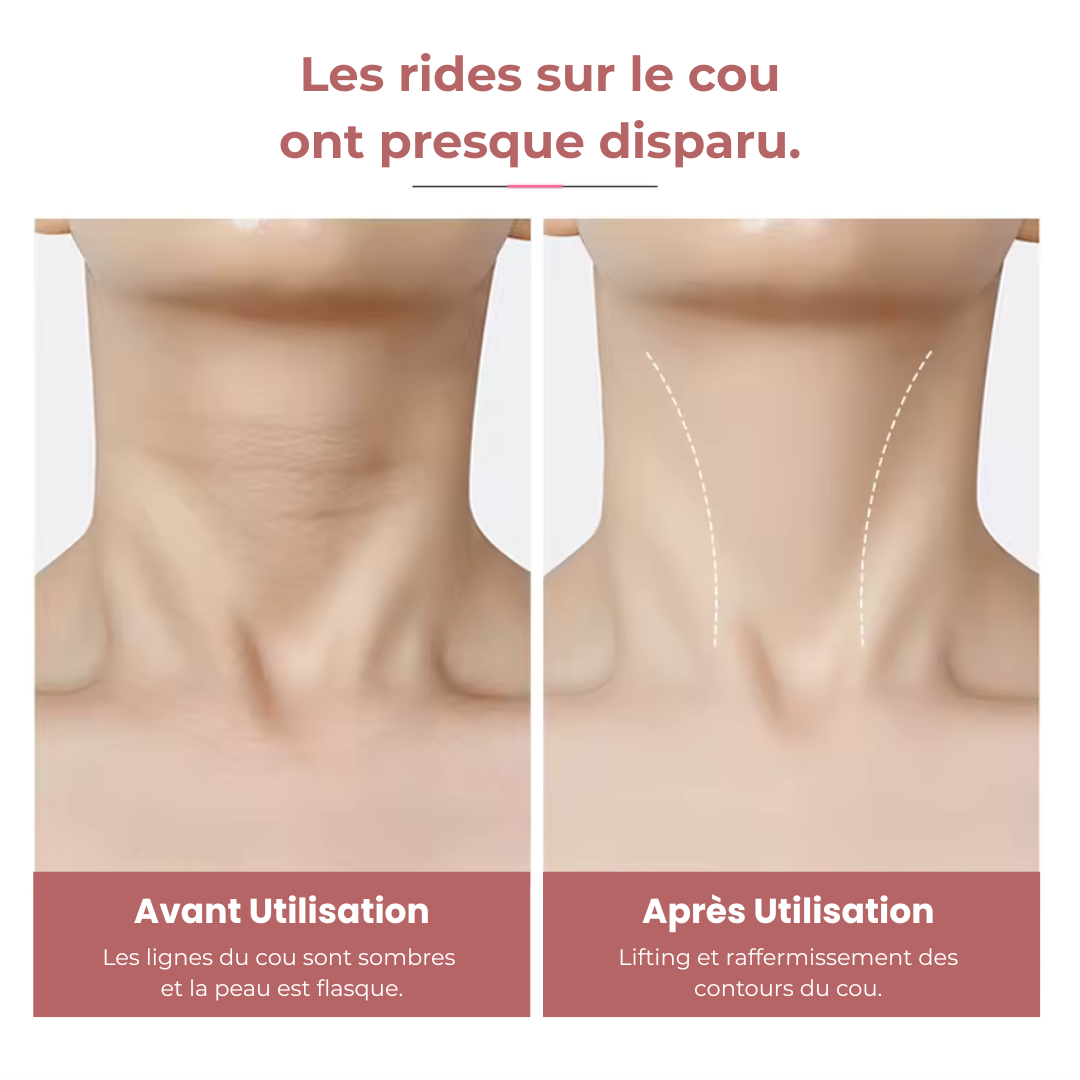 VieLoft Neck - Patchs remodelants